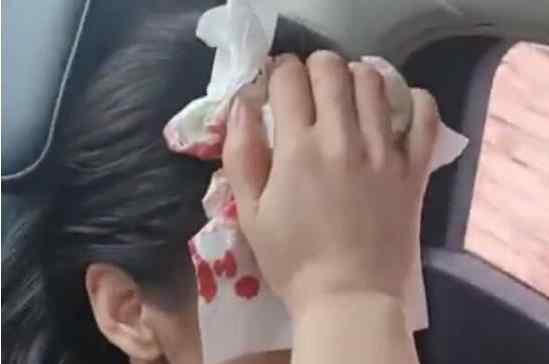 黄圣依拍戏时头部受伤 究竟发生了什么