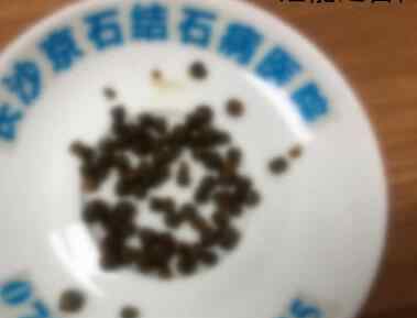 男子腹部剧痛入院以为是胃病 究竟发生了什么
