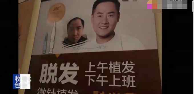 水太深！新华社暗访植发市场：“头顶经济”收割年轻群体 技术3天速成