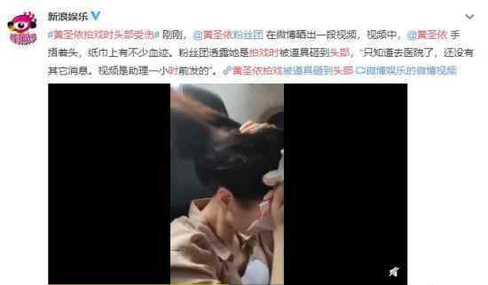 黄圣依拍戏时头部受伤 网友：千万要小心