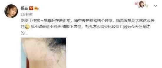 杨紫回应整形 杨紫如何回应的是去整形的吗