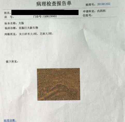 云南性息 他以为只是普通的痔疮，没想到竟然是三期肠癌！