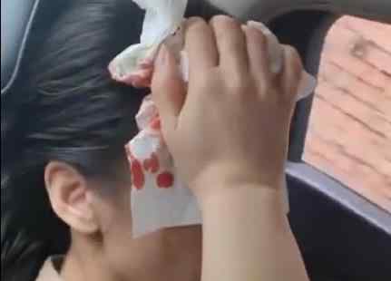 黄圣依拍戏时头部受伤 究竟发生了什么