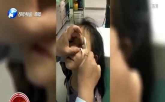 女童眼睛被塞几十片纸仍有疑云 什么疑云具体情况