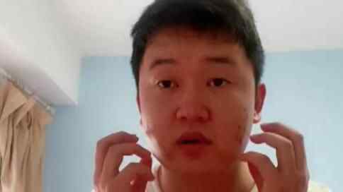 大连小伙再进隔离区热出花癣斑 到底发生了什么