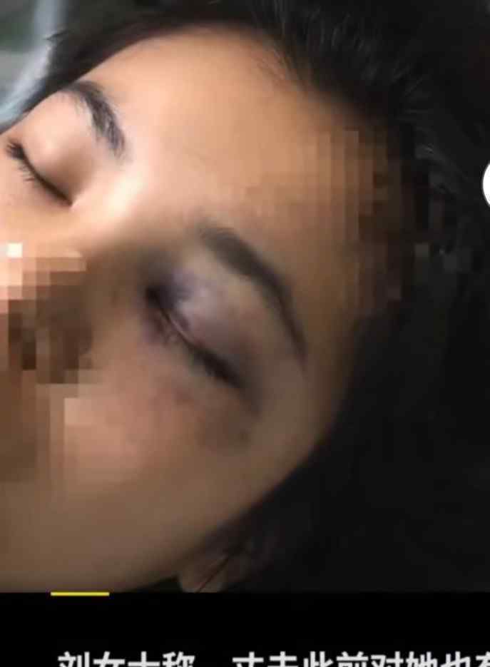 女子不堪家暴跳楼双下肢截瘫 到底发生了什么