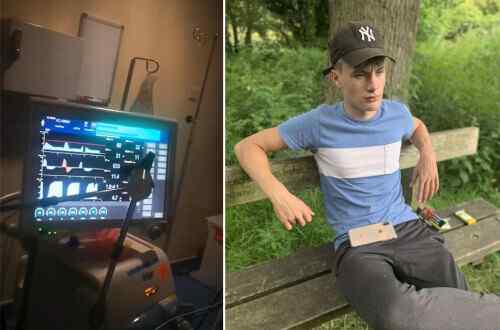 被宣布脑死亡后 英男子在做器官捐献手术前苏醒！医院：为数不多