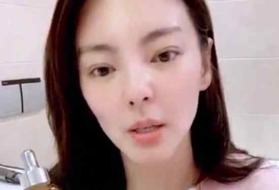 张雨绮鼻子怎么了被质疑整容官方有回应吗