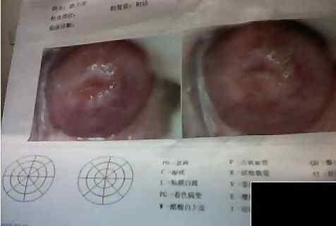 妇科病怎么治好 各种妇科炎症来袭，怎么治疗好