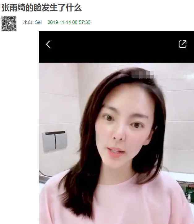 张雨绮鼻子 张雨绮鼻子怎么了整容了吗