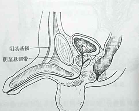 阴经延长术需要多少钱 总是觉得丁丁不够长？阴茎延长术有必要做吗？