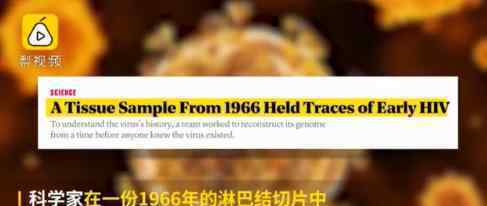 人类首次感染艾滋病毒时间或被提前 提前到什么时候