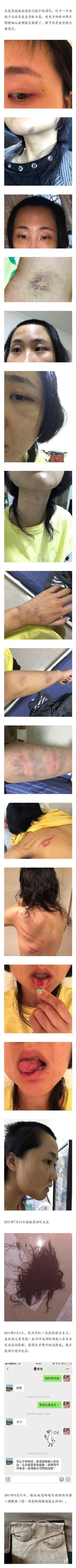 张嫮目疑家暴 不仅对其拳打脚踢还掰断女友手指