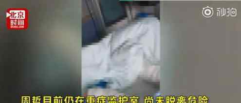 女孩模仿短视频被重度烧伤 模仿什么短视频女孩现在怎么样了?