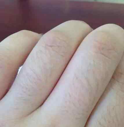 汗毛 汗毛重的女孩子有福气你不知道吧