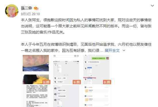 张嫮目疑家暴  张嫮目是谁家暴是什么情况?