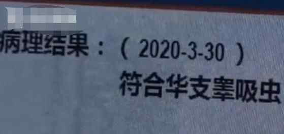 女子体内取出“活虫”还自由蠕动 只因爱吃这道菜真相简直令人崩溃