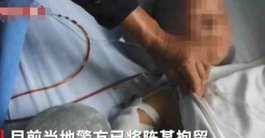 女童被继父连砍4刀确诊高位截瘫 案情经过回顾