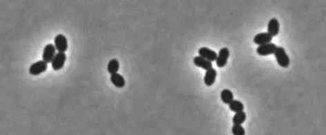 细菌细胞壁 杀菌就是爆炸！哈佛科学家终于揭开青霉素炸开细菌的50年谜题