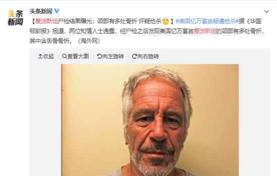 爱泼斯坦狱中自杀疑点重重?颈部骨多出骨折?