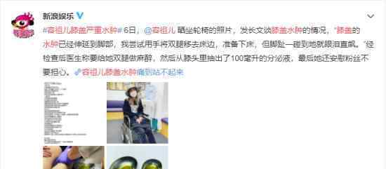 容祖儿膝盖严重水肿  什么情况（图）