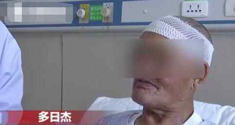 10厘米尖刀藏脑内 具体情况是怎么样