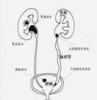 膀胱在什么位置 肾及输尿管的位置在哪呢?