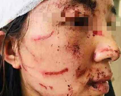 温州一女子遭公公和丈夫暴打 究竟是怎么回事