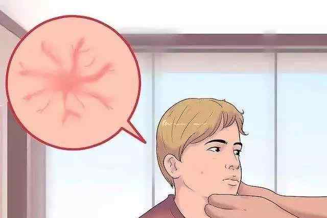 肝病都有哪些症状 肝病早期的症状都有什么？