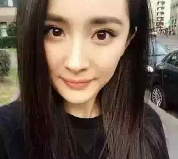 开眼角双眼皮 双眼皮到底要不要开眼角？文章配图