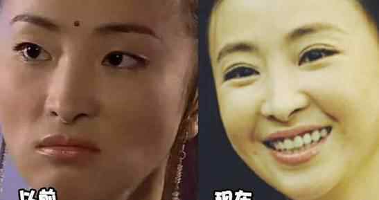 脸部填充 都自体脂肪脸部填充，为什么有人像仙，有人像鬼？