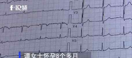 妈妈怀胎八月腹中突然没动静 医生检查看到可怕一幕究竟是怎么回事？