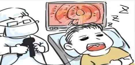 无痛胃镜和普通胃镜的区别 做胃镜，普通好还是无痛好？当初不懂，后悔选错！