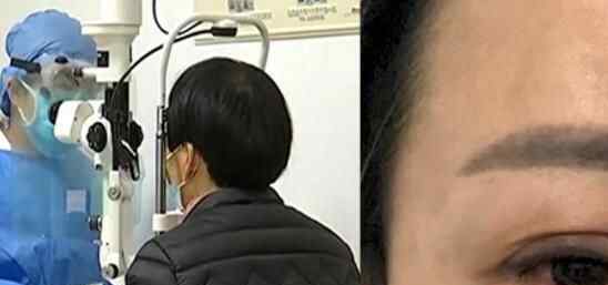 姑娘突然不停飙泪到医院一查角膜都快没了 原因叫人后怕究竟是怎么回事？