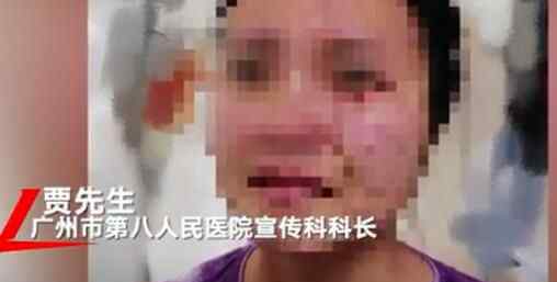 女护士被患新冠老外暴打撕咬满脸伤痕 对着镜头流泪令人心碎究竟是怎么回事？