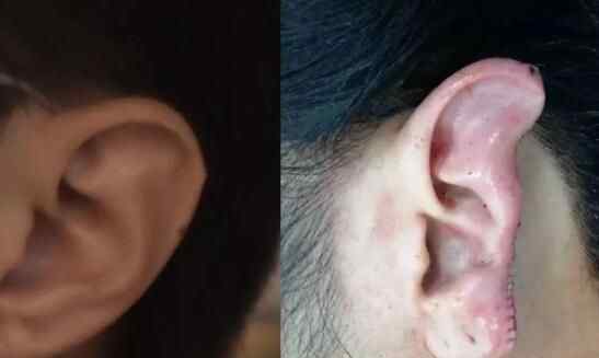 上海咬耳案犯罪嫌疑人落网 为什么咬耳朵什么原因？