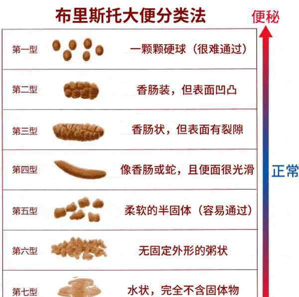 大便不成形但不是拉稀 辟谣！大便不成形一定是肠癌吗？别慌，医生告诉你怎么办