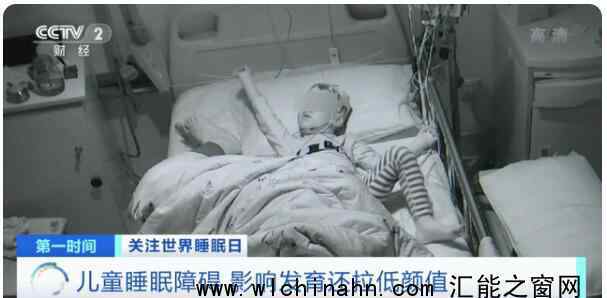 儿童睡不好或拉低颜值 究竟发生了什么