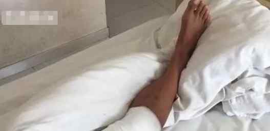 大爷烧伤后先抹盐水后抹大酱 背后真相实在让人惊愕