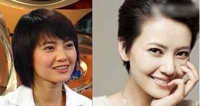 整牙似整容?整牙女星大变脸! 都变好看了呀