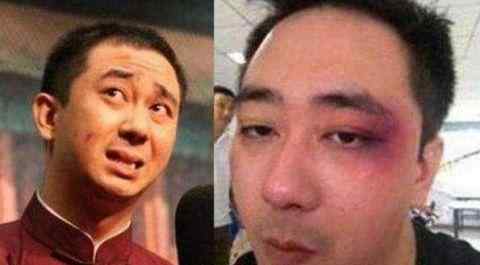 王自健前妻发文 王自健被老婆打是真的吗