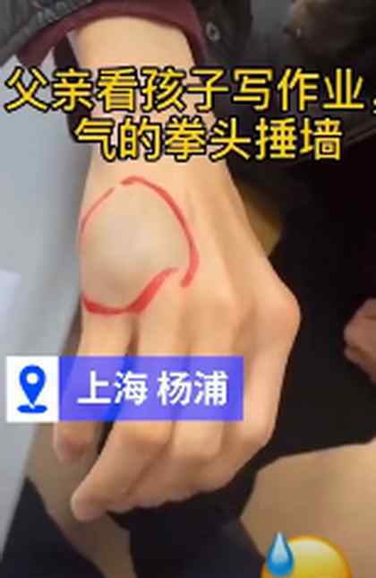 上海一爸爸辅导孩子作业，生气捶墙致骨折，网友：感同身受的“痛”
