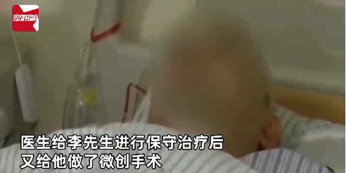 快放下挤痘痘的手！男子挤痘引发颅内脓肿 致上肢瘫痪