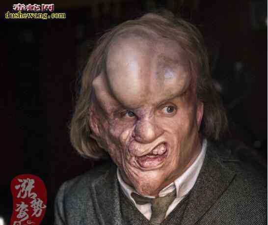 世界上最恐怖的10种人 全球十大恐怖畸形人