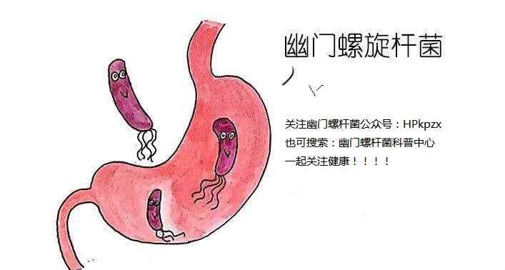 幽门杆菌引起的 幽门螺杆菌导致的疾病分为几大类？