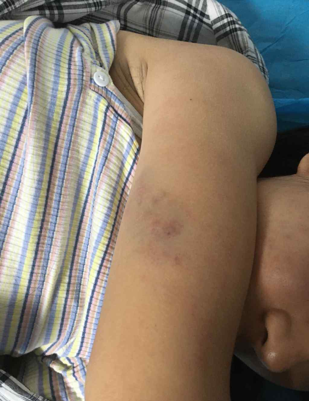 17岁女大学生被多人殴打并录像