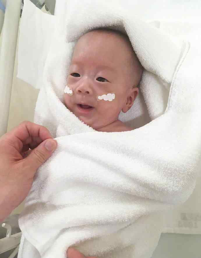 世界最小男婴出生时仅268克重量 相当于5个鸡蛋