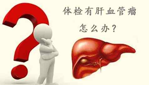 肝上血管瘤 体检查出肝内血管瘤，是怎么回事?严不严重?文章配图
