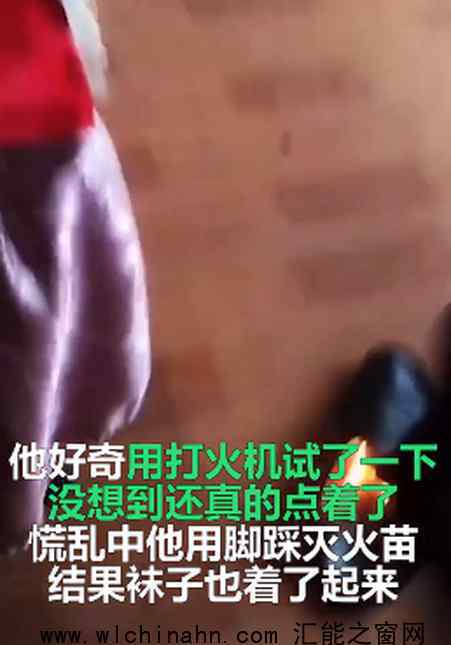 男子6天没洗脚，好奇点火竟把鞋袜点着 为什么要这样做