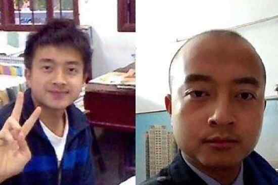 警察脱发对比图 为什么脱发究竟是怎么回事？